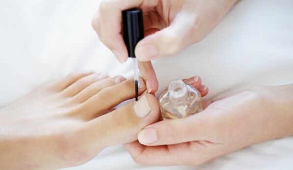 Aplikácia liečivého laku na nechty je povinný denný postup počas liečby hubami. 