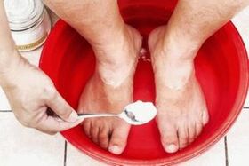 Kúpeľ so sódou a dechtovým mydlom odstráni plesne na nohách